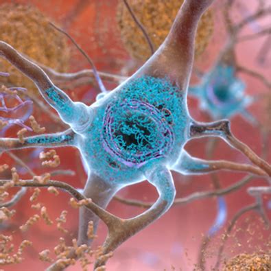 A gene guiding brain cell growth may regulate Alzheimer’s plaque .